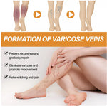 Turmeric Varicose Vein Relief Spray Buy 1 Get 1 Free