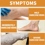 Turmeric Varicose Vein Relief Spray Buy 1 Get 1 Free